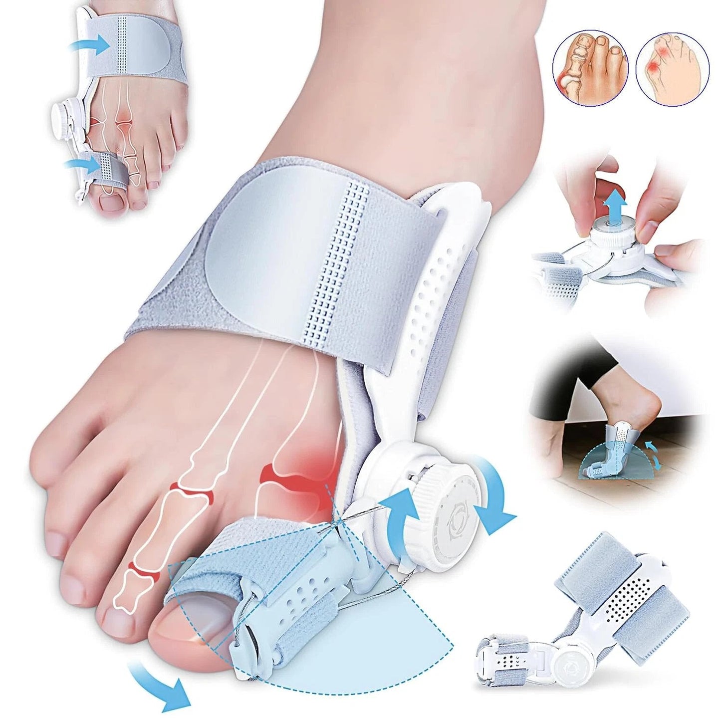 š„Big Promotion 49% OFFš„Orthopedic Bunion Corrector