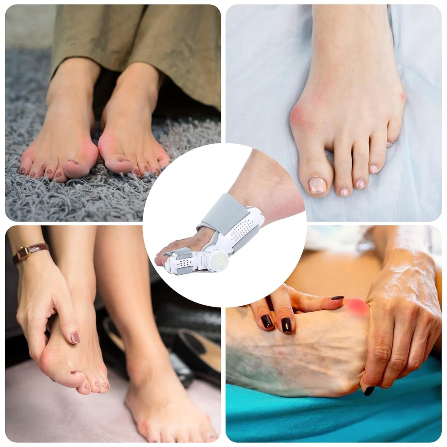 š„Big Promotion 49% OFFš„Orthopedic Bunion Corrector