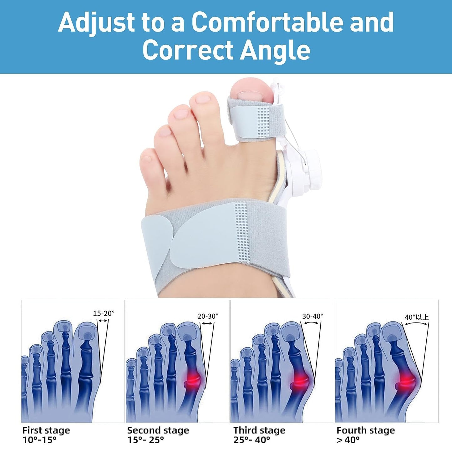 š„Big Promotion 49% OFFš„Orthopedic Bunion Corrector