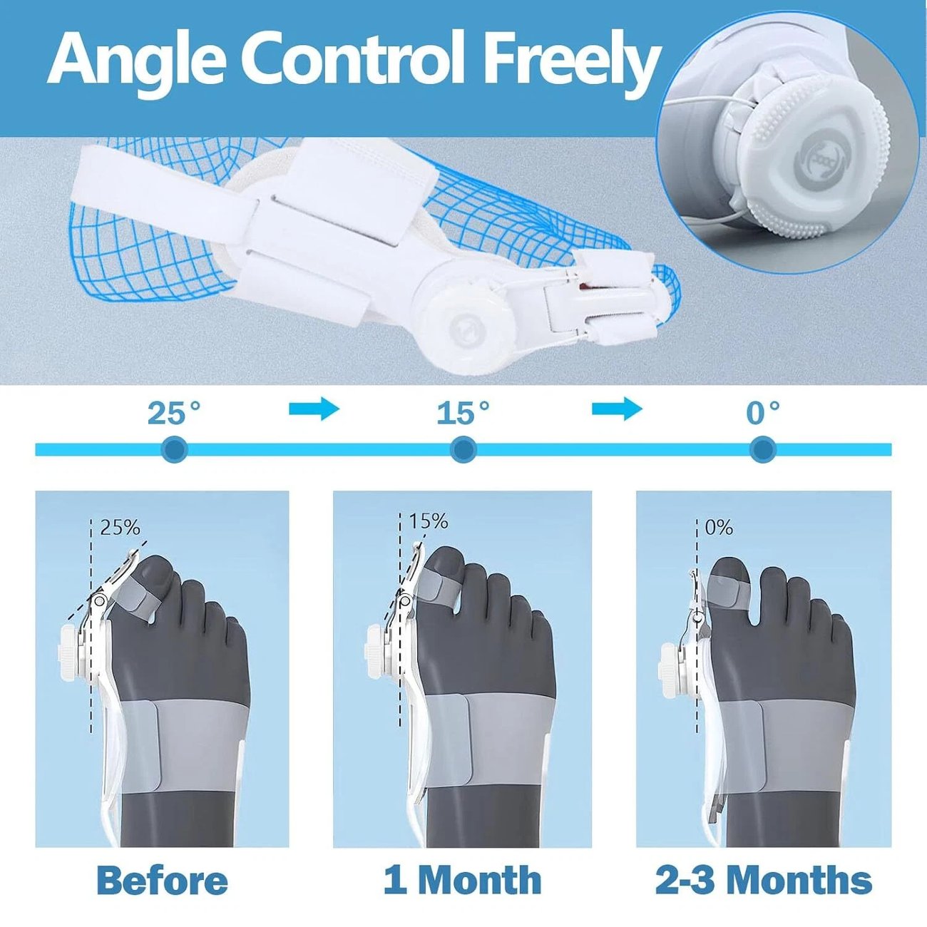 š„Big Promotion 49% OFFš„Orthopedic Bunion Corrector